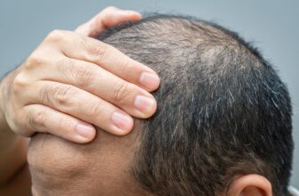 An Off-Label Hair Loss Tablet Is Going Mainstream, However Questions Stay
